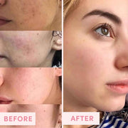 Sand & Sky Australian Pink Clay Face Mask with Vitamin C – Detoxifying Pore Cleanser for Blemish-Prone Skin, Brightening & Even Skin Tone – 60g