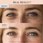 Beauty of Joseon Revive Eye Serum – Retinal & Niacinamide for Dark Circles, Fine Lines & Puffiness (30ml)