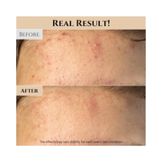 Beauty of Joseon Ground Rice & Honey Glow Mask 150ml – Pore Care, Sebum Control & Deep Glow for Dry & Sensitive Skin