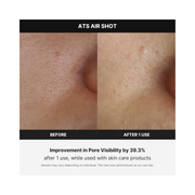 Medicube Age-R ATS Air Shot – At-Home Microneedling Skincare Device | Pore Tightening, Exfoliation & Enhanced Absorption | Smoother Skin Texture & Rejuvenation