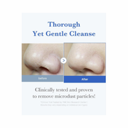 Medicube Zero Pore Cleansing Foam – Deep Cleansing Vegan Face Wash for Smooth, Refined Pores (120g)