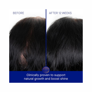 Augustinus Bader The Scalp Treatment – Luxury Restorative Serum – Hydrating, Nourishing & Soothing Formula for Healthier, Fuller Hair