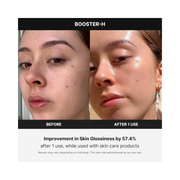 Medicube AGE-R Booster H – Needle-Free Facial Glow Booster | Korean Skincare Device for Enhanced Absorption & Radiance | At-Home Glass Skin Tool