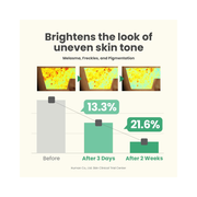 AXIS-Y Dark Spot Correcting Glow Serum | 5% Niacinamide Brightening Serum for Dark Spots & Uneven Skin Tone | Vegan Korean Skincare