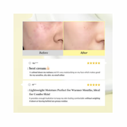 Dr. Althea 345 Relief Cream – Soothing & Barrier Repair Moisturizer with Niacinamide, Panthenol & Ceramides (50ml)