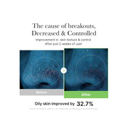 Medicube Exosome Cica Toner – Daily Soothing Toner with Heartleaf, Tea Tree & 12 Cica Complex | Low-Irritation Sebum Control & Skin Balancing Korean Skincare, 210 ml