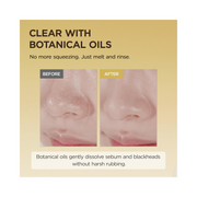 SKIN1004 Madagascar Centella Light Cleansing Oil – Gentle Korean Facial Cleanser with Centella Asiatica (200ml / 6.76 fl.oz)