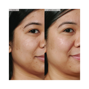 Glow Recipe Niacinamide Dew Drops Brightening Serum – 40ml