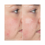 Augustinus Bader The Foaming Cleanser – Luxury Gentle Hydrating Face Cleanser with TFC8® – Removes Impurities & Supports Skin Barrier