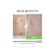 medicube Exosome Cica Tea Tree Ampoule – Soothing Serum for Sensitive Skin with Centella Asiatica & Tea Tree | Redness Relief, Breakout Care, Hydrating Korean Skincare | 30ml