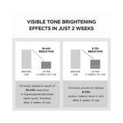 SKIN1004 Madagascar Centella Tone Brightening Capsule Cream | 75ml (2.53 fl.oz) | Hydrating, Non-Sticky Brightening Cream for Sensitive & Acne-Prone Skin