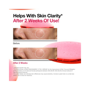 ANUA Niacinamide 10 + TXA 4 Serum – Brightening Facial Serum with Hyaluronic Acid & Arbutin for Glass Skin and Dark Spot Correction