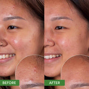 Sand & Sky Oil Control Gentle Face Cleanser – AHA + BHA Blemish Cleanser for Oily & Acne-Prone Skin, 4.2 fl oz